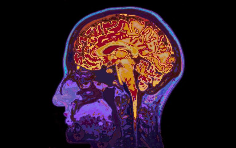 The human brain in scan