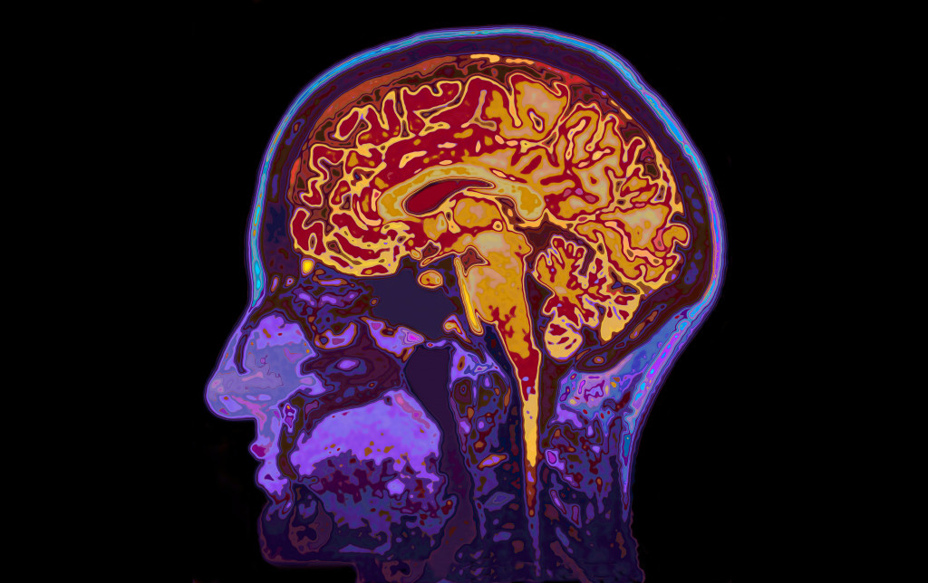 The human brain in scan